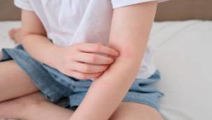 Çocuklarda 'Alerjik Hastalıklar' Hakkında Doğru Sanılan 8 Hatalı Bilgi!